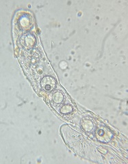Lamprospora miniata