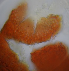 Pseudocosmospora eutypae