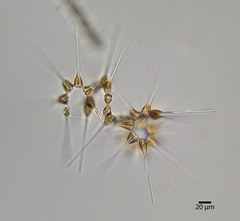 Asterionellopsis glacialis