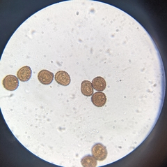 Puccinia hieracii