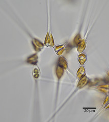 Asterionellopsis glacialis