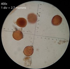 Glomeromycota