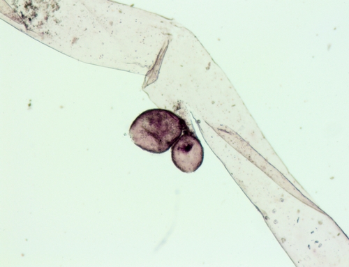 Vaucheria dichotoma observed 2019-07-19