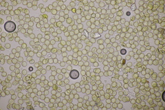 Hemitrichia calyculata