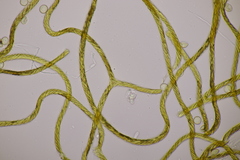 Hemitrichia calyculata