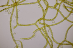 Hemitrichia calyculata