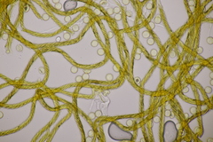 Hemitrichia calyculata