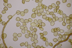 Metatrichia floriformis