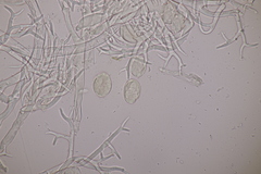 Peronospora corydalis