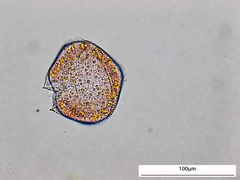 Protoperidinium