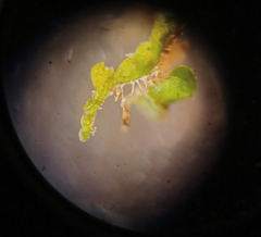 Odontoschisma denudatum