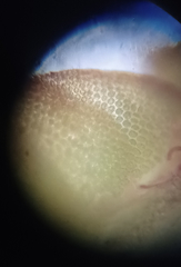 Odontoschisma denudatum