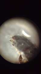 Macroscytus brunneus