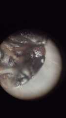 Macroscytus brunneus