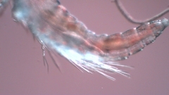 Canthocamptus staphylinus