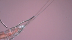 Canthocamptus staphylinus