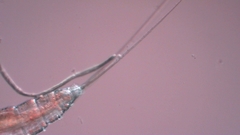 Canthocamptus staphylinus