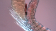 Canthocamptus staphylinus