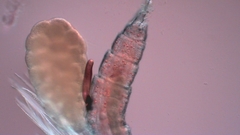 Canthocamptus staphylinus