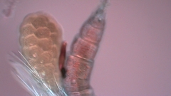 Canthocamptus staphylinus