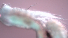 Canthocamptus staphylinus