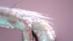 Canthocamptus staphylinus