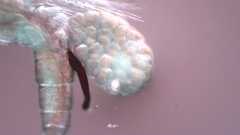 Canthocamptus staphylinus