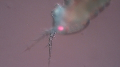 Canthocamptus staphylinus