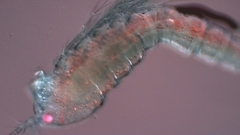 Canthocamptus staphylinus