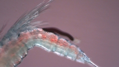 Canthocamptus staphylinus