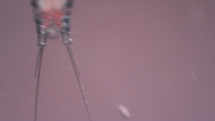 Canthocamptus staphylinus