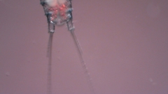 Canthocamptus staphylinus