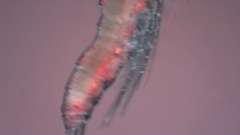 Canthocamptus staphylinus