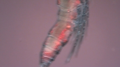 Canthocamptus staphylinus