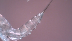 Canthocamptus staphylinus