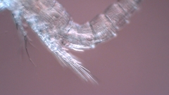 Canthocamptus staphylinus