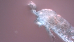 Canthocamptus staphylinus