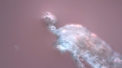 Canthocamptus staphylinus