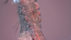 Canthocamptus staphylinus