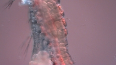 Canthocamptus staphylinus