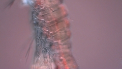 Canthocamptus staphylinus