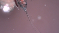 Canthocamptus staphylinus