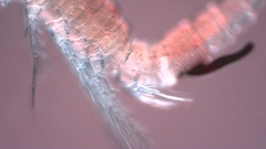 Canthocamptus staphylinus