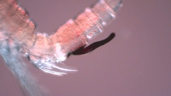 Canthocamptus staphylinus