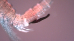 Canthocamptus staphylinus