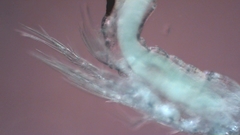 Canthocamptus staphylinus