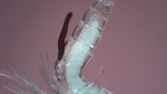 Canthocamptus staphylinus