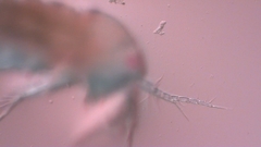 Canthocamptus staphylinus