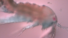 Canthocamptus staphylinus