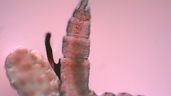 Canthocamptus staphylinus